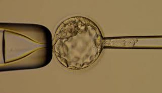 PGT-A Embryo Biopsy